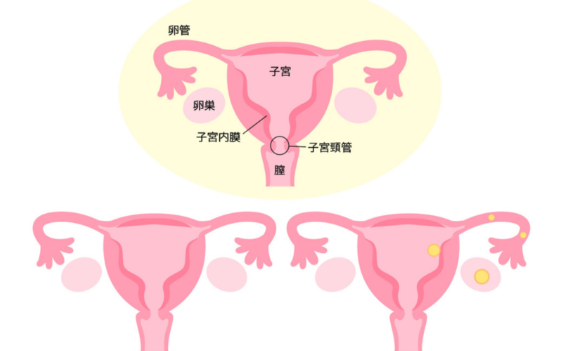 子宮と卵巣 【出張産前産後ケアのジャイマー】｜ユーファイ・マタニティ・カウンセリング